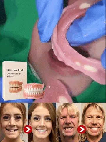 🦷Epic Upgrade Premium Full Cover Dentures🦷
