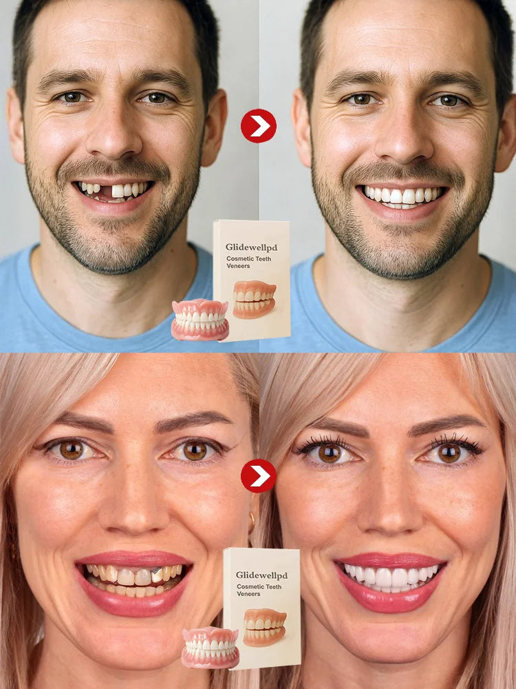 🦷Epic Upgrade Premium Full Cover Dentures🦷