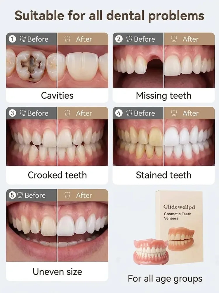 🦷Epic Upgrade Premium Full Cover Dentures🦷