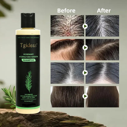Rosemary Shampoo | Hair Growth & Anti-Dandruff Scalp Treatment