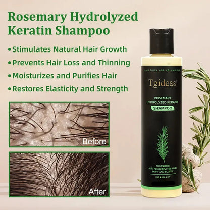Rosemary Shampoo | Hair Growth & Anti-Dandruff Scalp Treatment